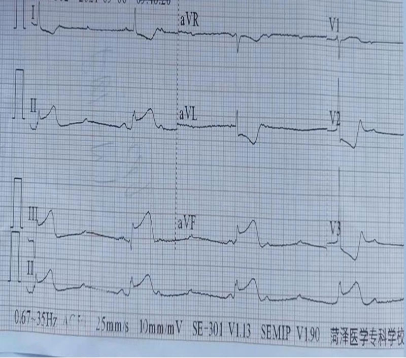 菏澤醫(yī)專(zhuān)附屬醫(yī)院