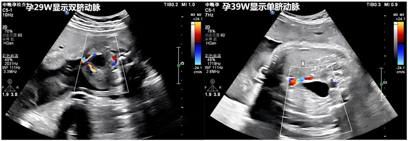 菏澤醫(yī)專附屬醫(yī)院