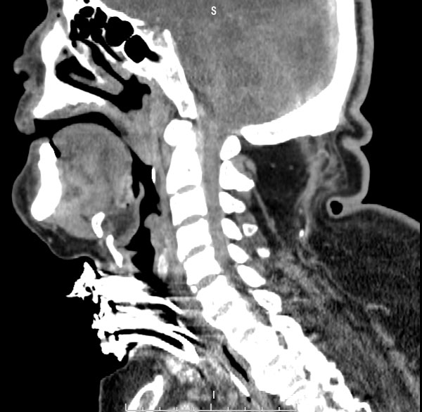 菏澤醫(yī)專附屬醫(yī)院